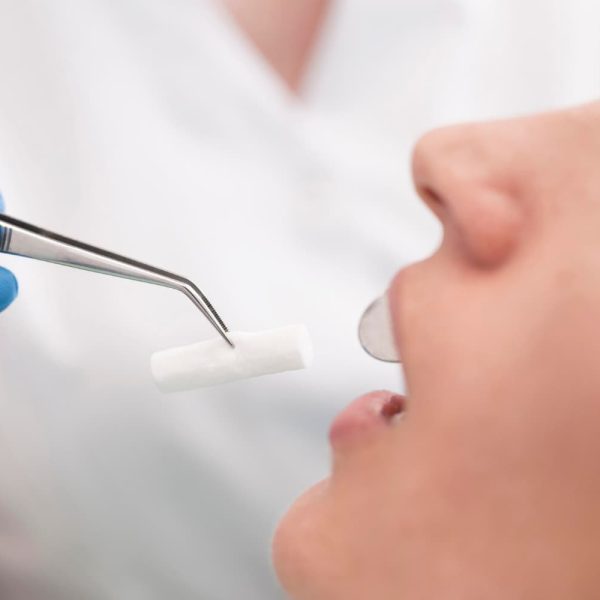 prevenir la candidiasis oral